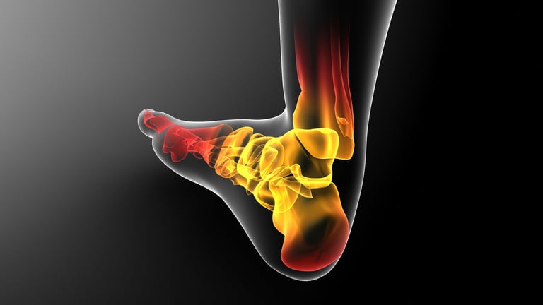 Plantar fasciitis heel pain treatment